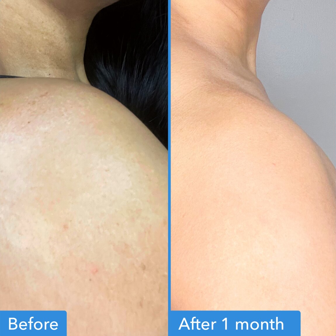 discoloration-correcting-body-treatment-t7 zb_p.jpg