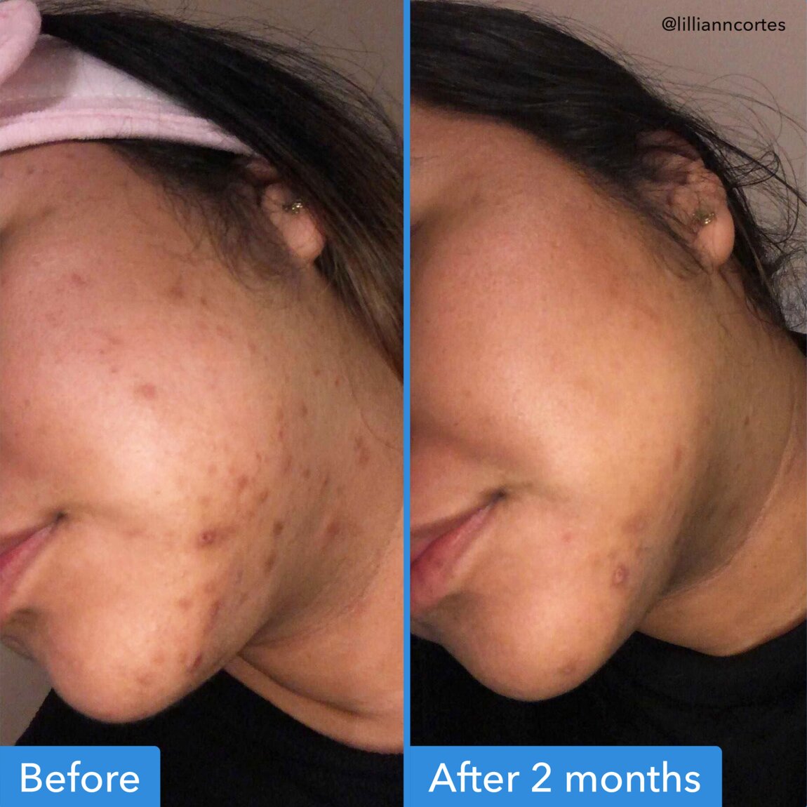 discoloration-correcting-serum-e8 zb_p.jpg